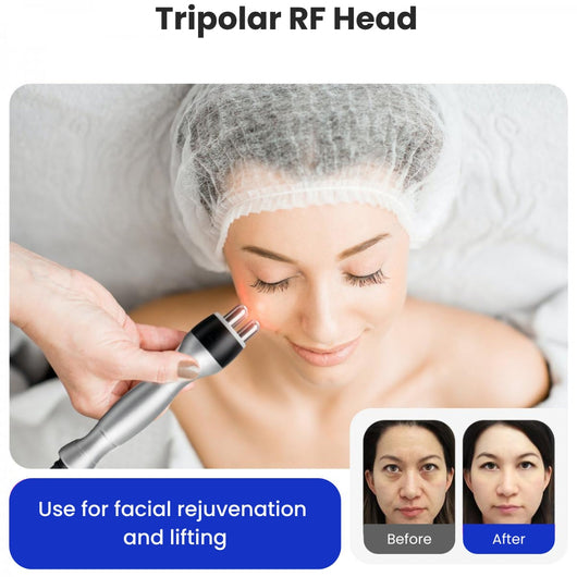 Ultrasonic Cavitation Machine + FREE GIFTS