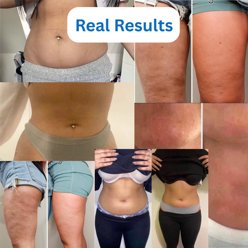 Ultrasonic Cavitation Machine + FREE GIFTS