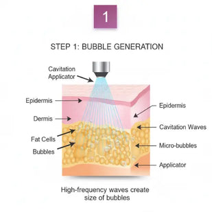 Targets Stubborn Fat